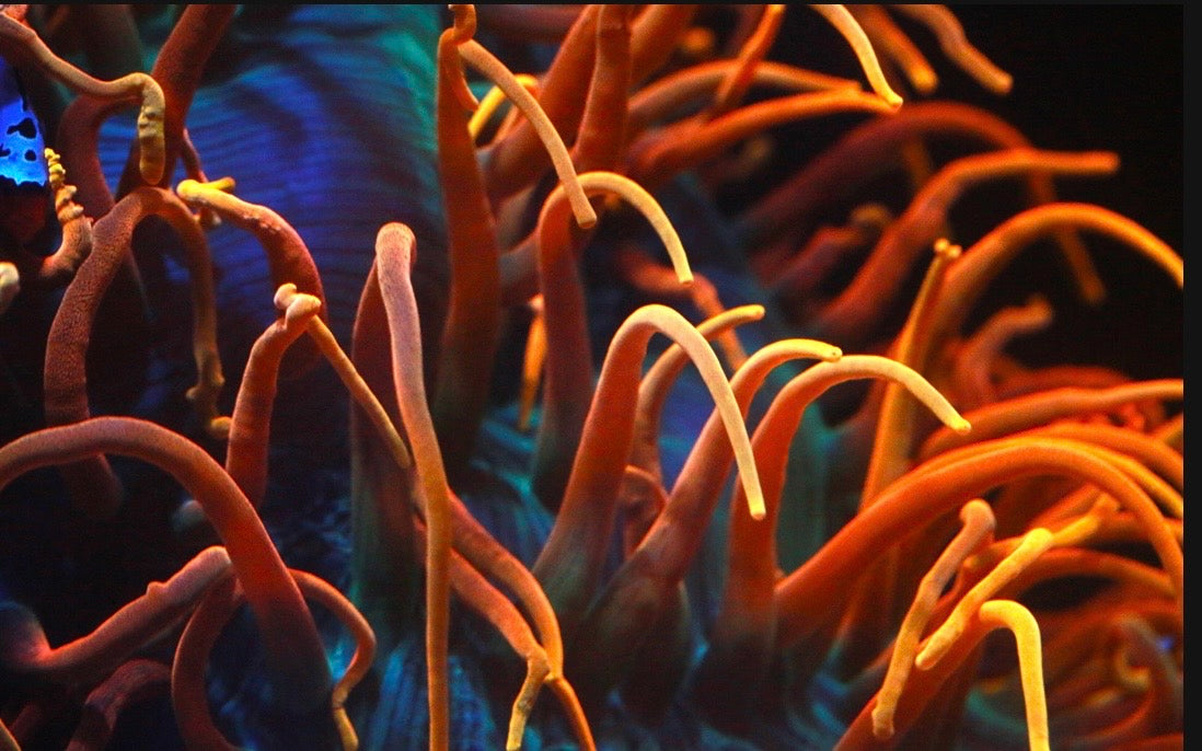 Anemone     >